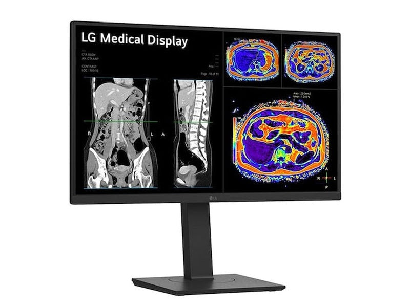 LG 27” 27HS713C-B 8MP IPS Clinical Review Monitor