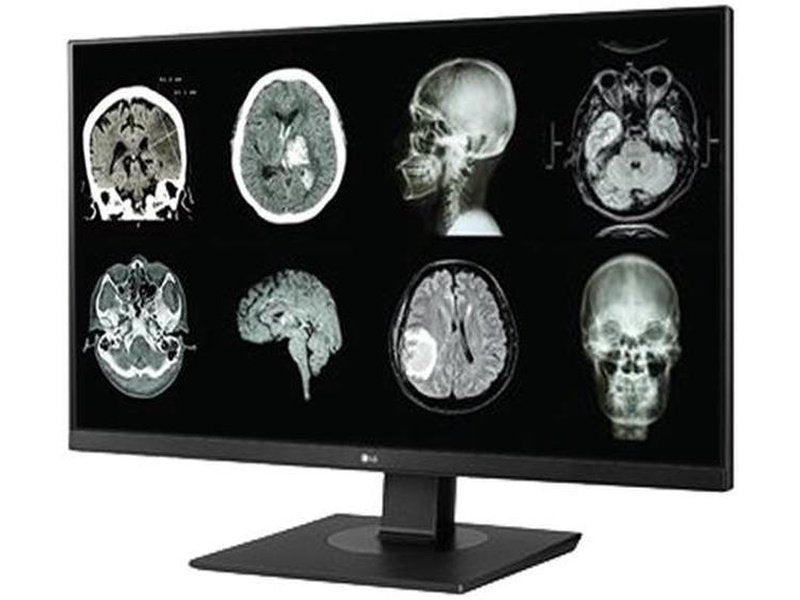 LG 27HJ713C-B 27" UHD IPS 8MP Clinical Review Monitor