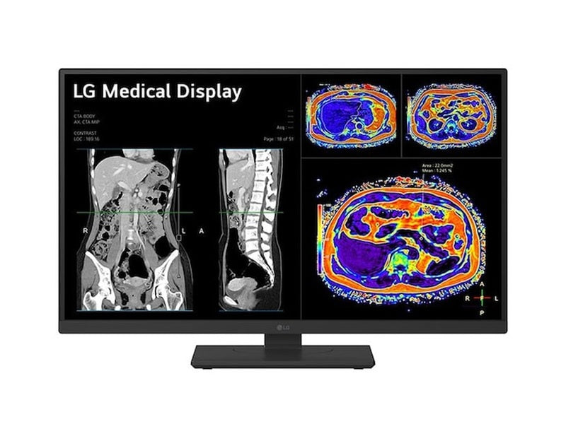 LG 27” 27HS713C-B 8MP IPS Clinical Review Monitor