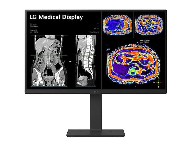 LG 27” 27HS713C-B 8MP IPS Clinical Review Monitor