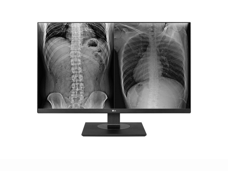 LG 27HJ713C-B 27" UHD IPS 8MP Clinical Review Monitor